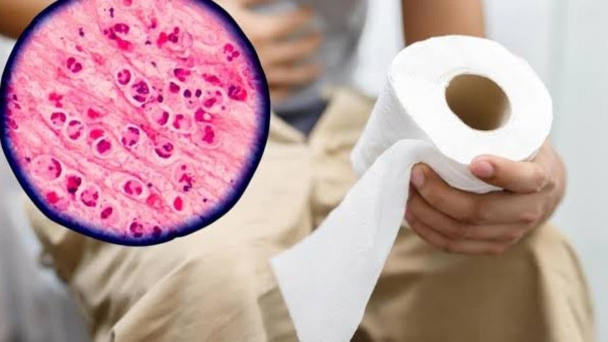 ¿Hay brote de ciclosporiasis o diarrea "explosiva" en República Dominicana? Salud Pública responde