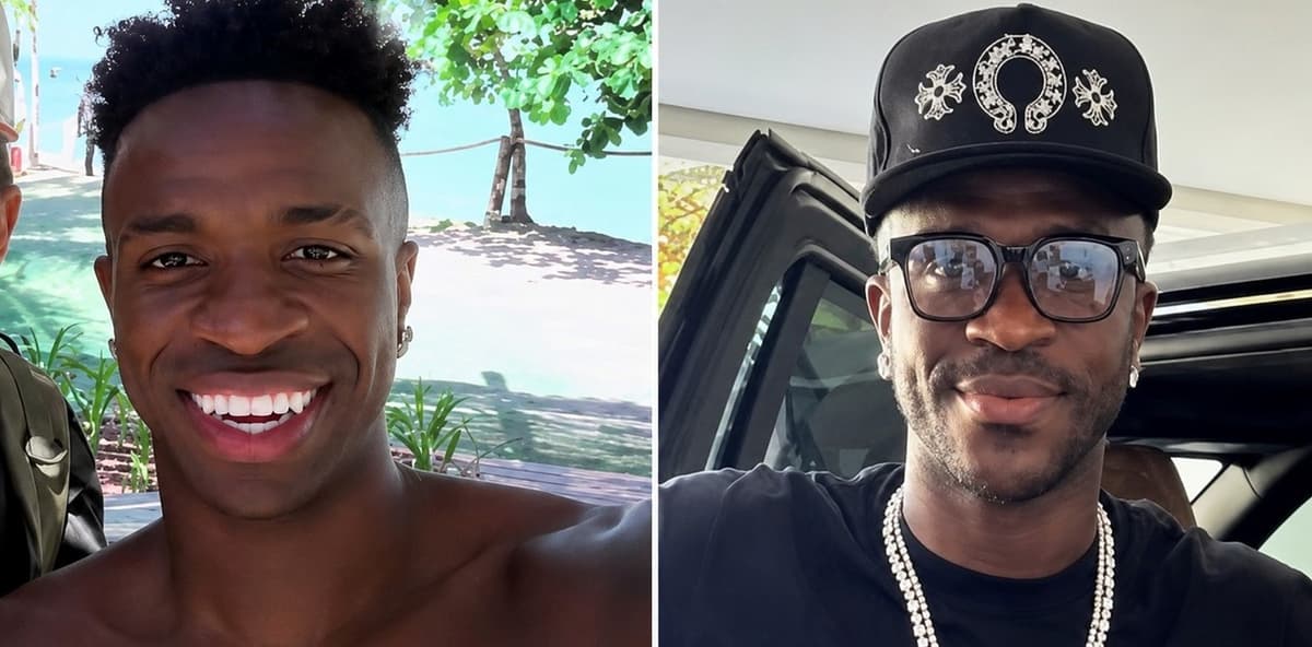 Vinícius Jr. sorprende con un cambio de imagen tras una cirugía estética facial