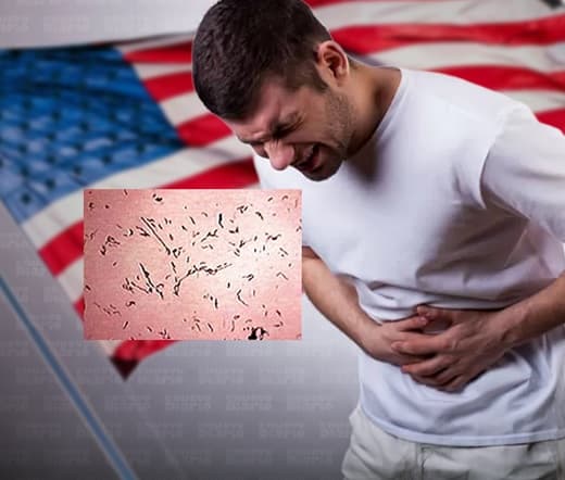 Instan neoyorkinos tomar precauciones adicionales con productos infesta el intestino delgado