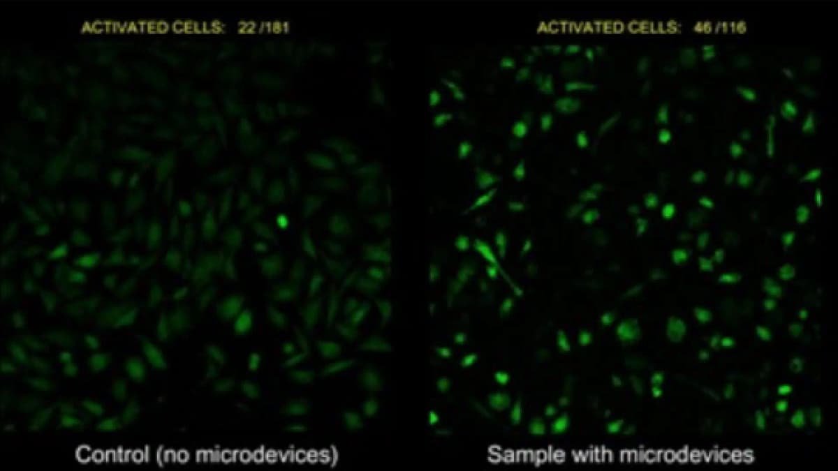 Nuevos microdispositivos consiguen activar células a distancia mediante ultrasonidos: "Permitirían una terapia muy precisa y dirigida"