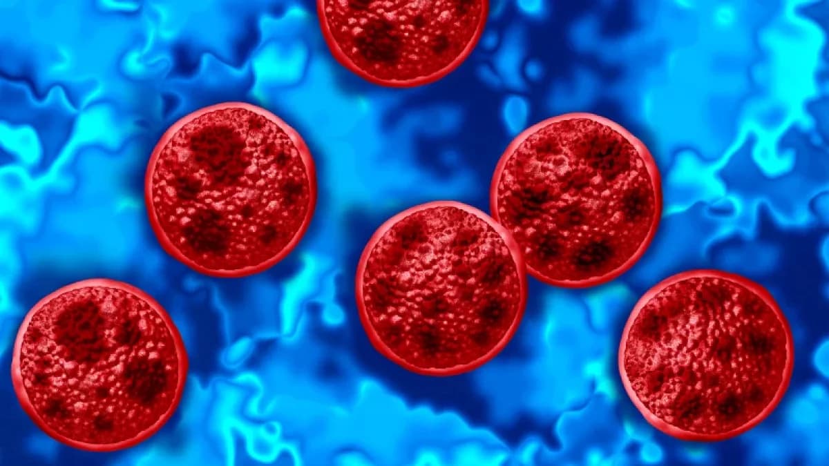 México reporta tres casos de Cyclospora y descarta un brote: lo que se sabe hasta ahora