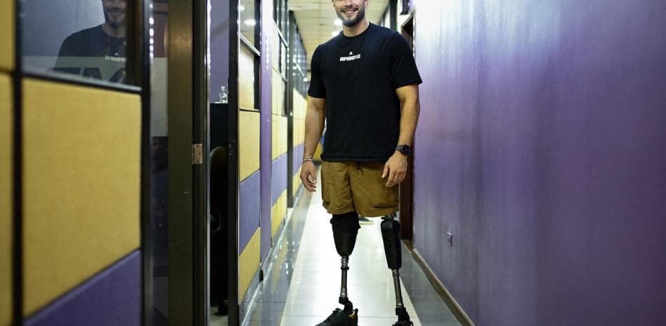 Después de una amputación por sismos en Venezuela, sobrevivir y empezar de cero