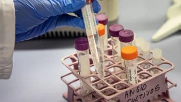Terapia génica busca frenar el desarrollo del alzhéimer