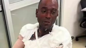 Hombre es quemado con agua caliente en Samaná