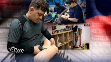 El reto de dotar de prótesis a los amputados de los terremotos en Venezuela